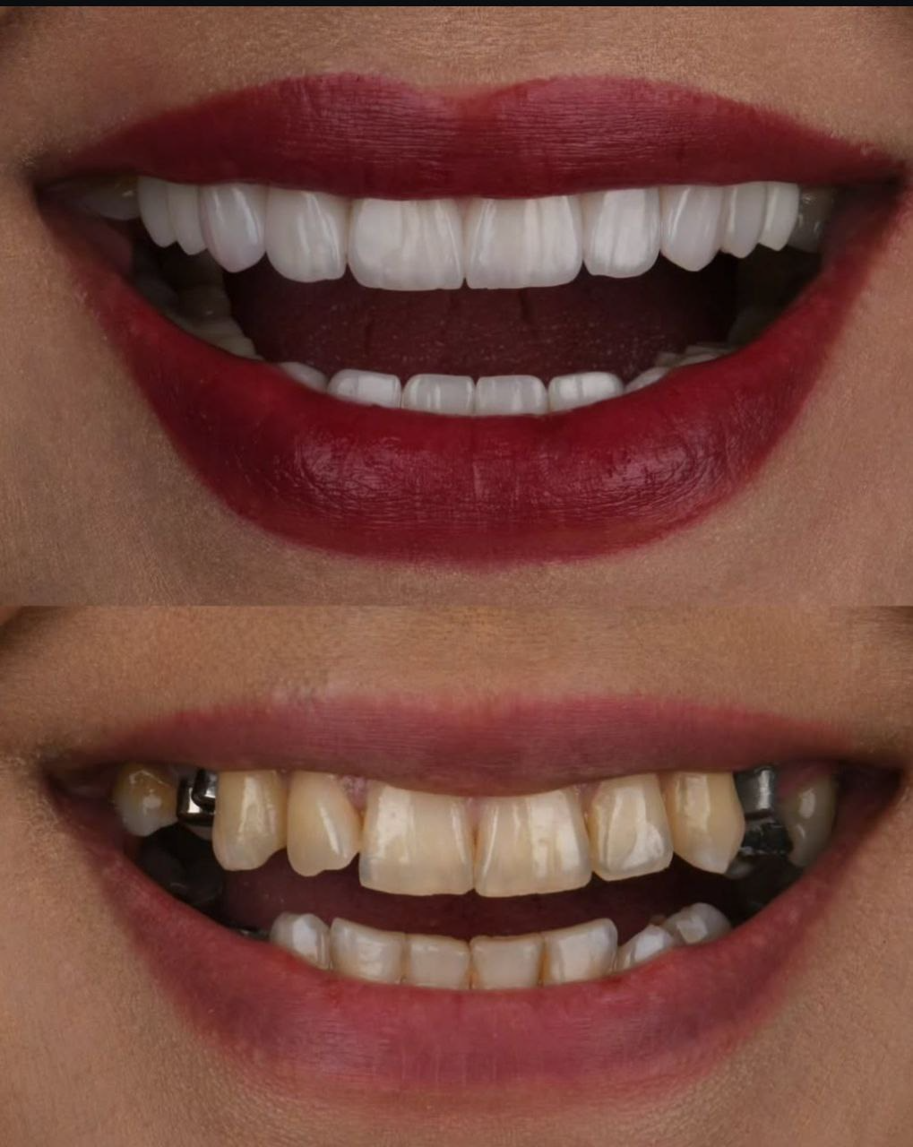 Dental Treatment Detail