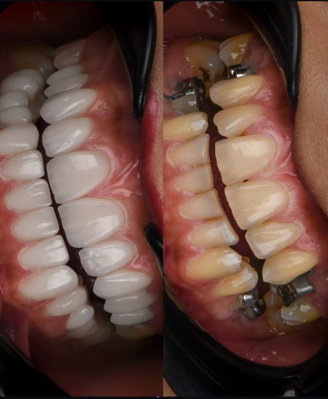Dental Work Detail