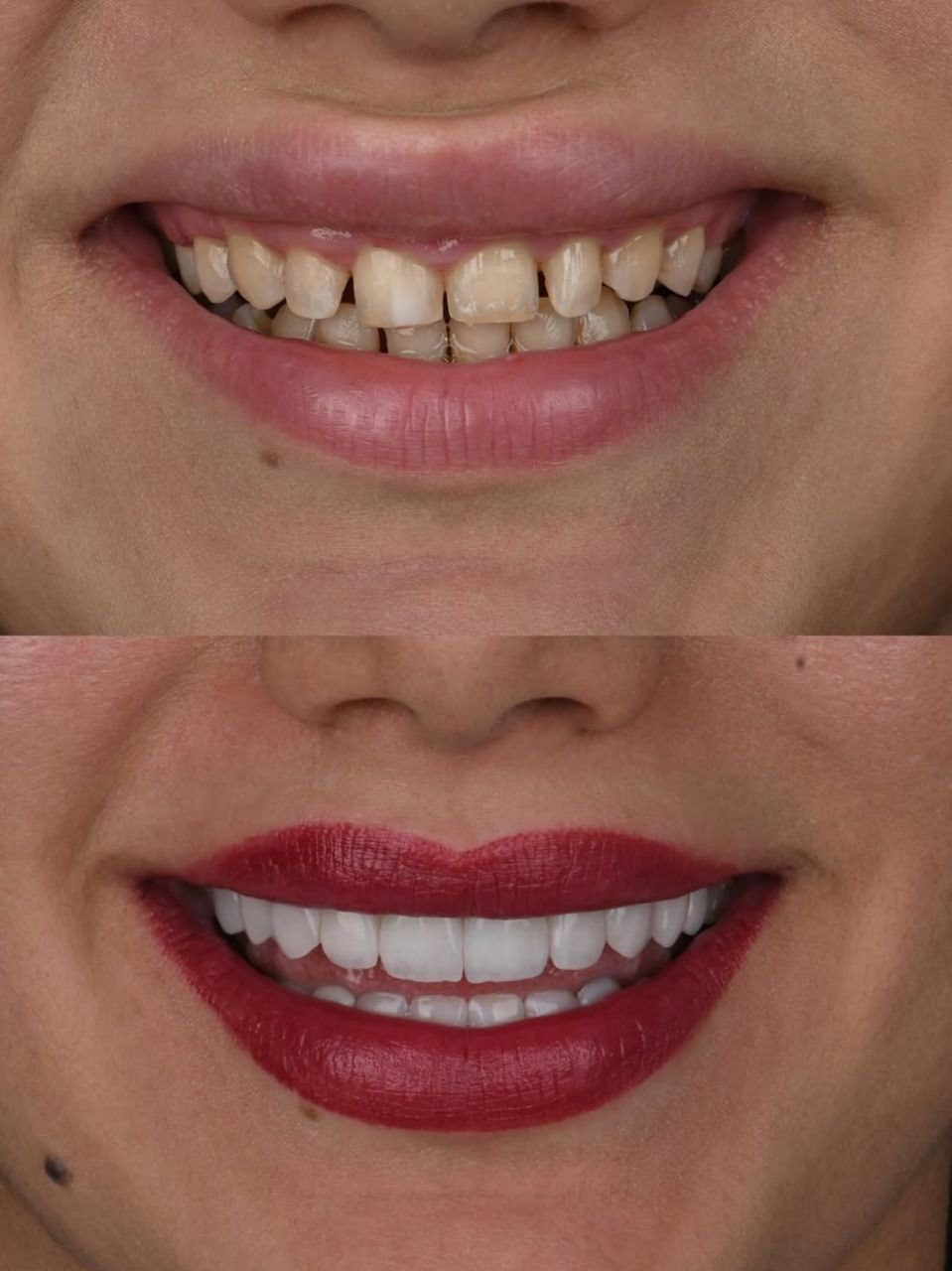 Detailed Dental Work